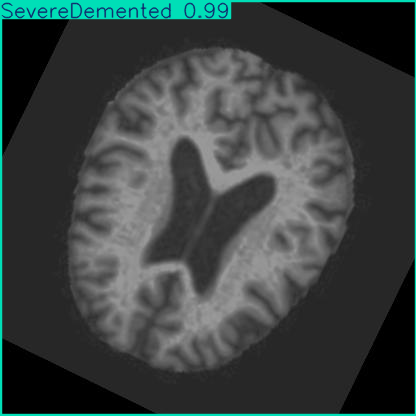 Alzheimer's Brain Image