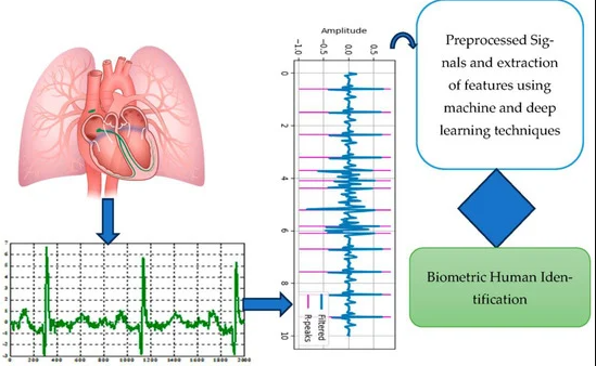 ECG Authentication