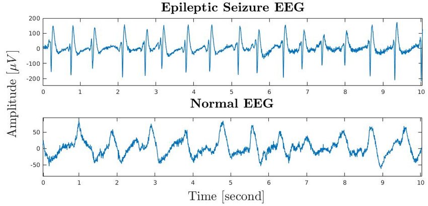 Epilepsy EEG Image