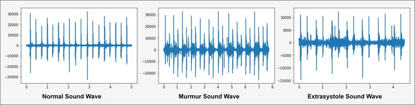 Heartbeat Sound Waveform