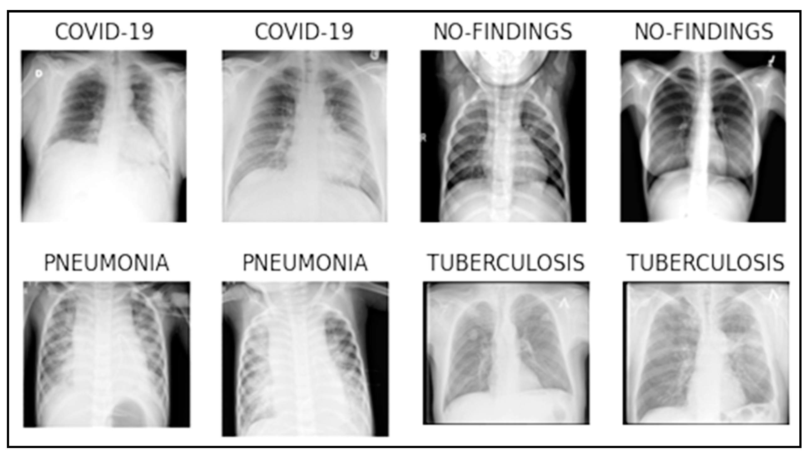 Lung Disease Image