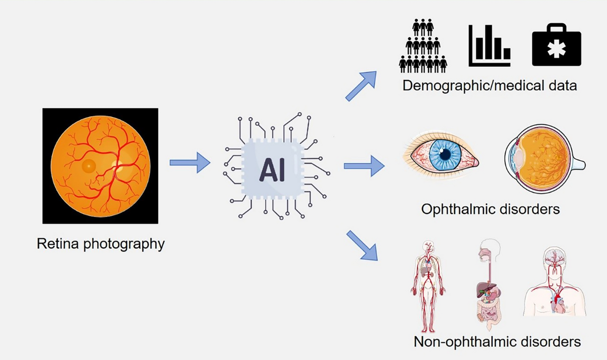 Future of AI in healthcare